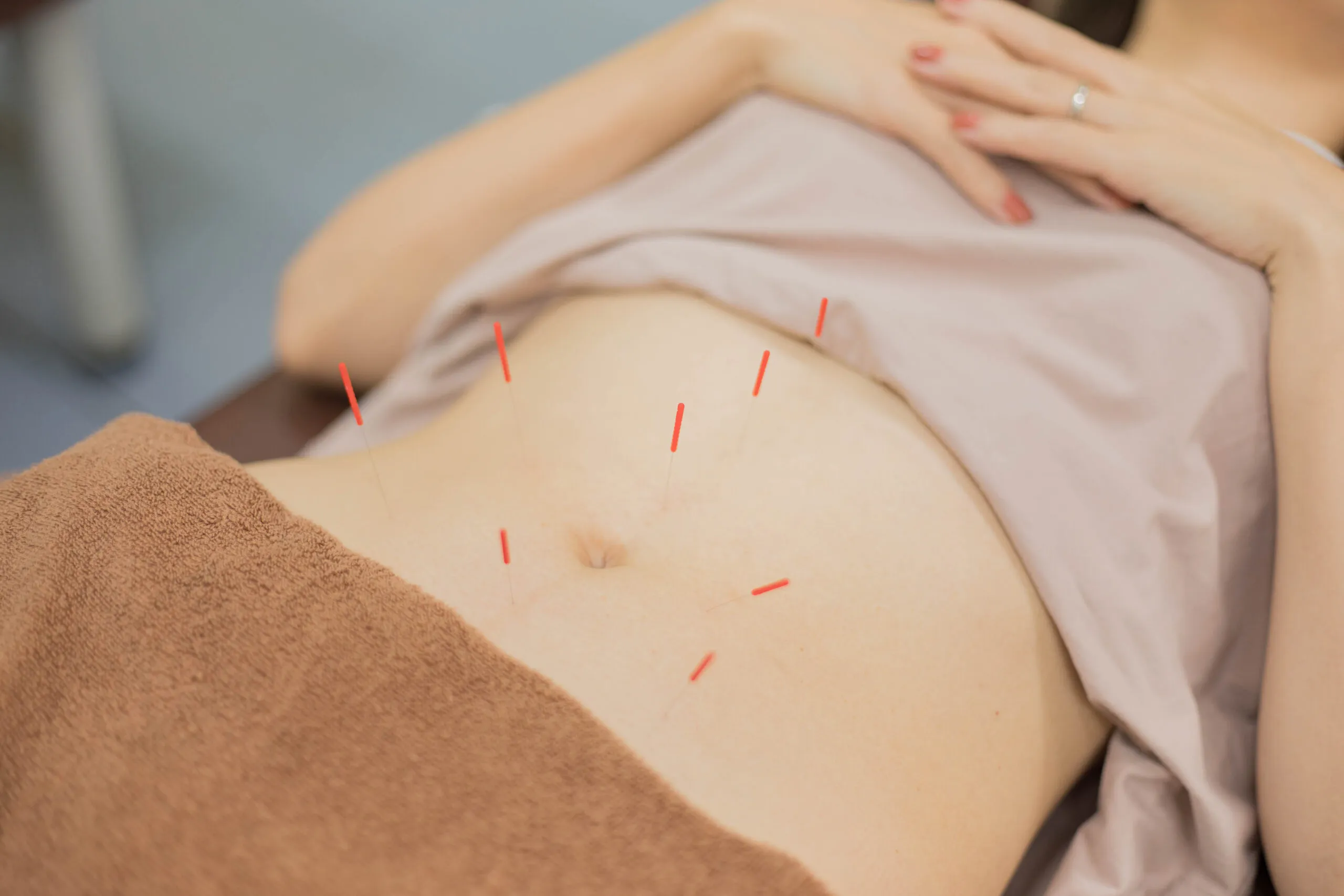 十条中央接骨院の経穴へのアプローチ施術の様子